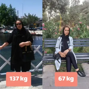 خدمات جراحی و زیبایی اقساطی در کلینیک اسلیم بیوتی خدمات جراحی و زیبایی اقساطی در کلینیک اسلیم بیوتی با امکان پرداخت اقساطی ارائه می‌دهد. از جمله این خدمات جراحی لاغری، لیپوماتیک، ابدومینوپلاستی و بلفاروپلاستی