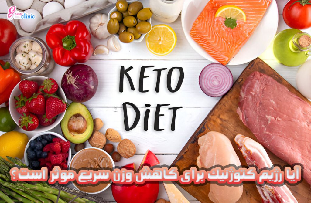 رژیم کتوژنیک چیست و چگونه باعث کاهش وزن میشود؟ مناسب برای بعد از جراحیهای لاغری مانند اسلیو معده، با مشاوره تخصصی در کلینیک اسلیم بیوتی