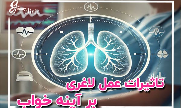 نماد درمان آپنه خواب با جراحی لاغری ✨ خواب راحت با جراحی لاغری: درمان آپنه خواب+علائم آپنه خواب 🎯 خواب راحت با جراحی لاغری: درمان آپنه خواب و علائم آن با روش‌های نوین در کلینیک اسلیم بیوتی. کاهش وزن و جراحی‌های تخصصی برای بهبود خواب و مشکلات تنفسی در شب.