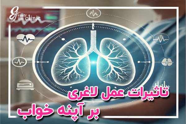 نماد درمان آپنه خواب با جراحی لاغری ✨ خواب راحت با جراحی لاغری: درمان آپنه خواب+علائم آپنه خواب 🎯 خواب راحت با جراحی لاغری: درمان آپنه خواب و علائم آن با روش‌های نوین در کلینیک اسلیم بیوتی. کاهش وزن و جراحی‌های تخصصی برای بهبود خواب و مشکلات تنفسی در شب.