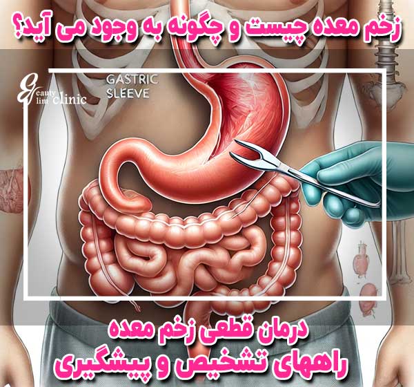 "زخم معده یکی از بیماری‌های شایع گوارشی است که می‌تواند به درد و ناراحتی‌های زیادی منجر شود. در این مقاله از کلینیک اسلیم بیوتی، به علائم، علل و روش‌های درمان زخم معده پرداخته‌ایم. همچنین، به نکات پیشگیری و درمان‌های خانگی برای کاهش علائم آن اشاره شده است. برای کسب اطلاعات بیشتر و بهبود سلامت دستگاه گوارش خود، با ما همراه باشید."


2/2







