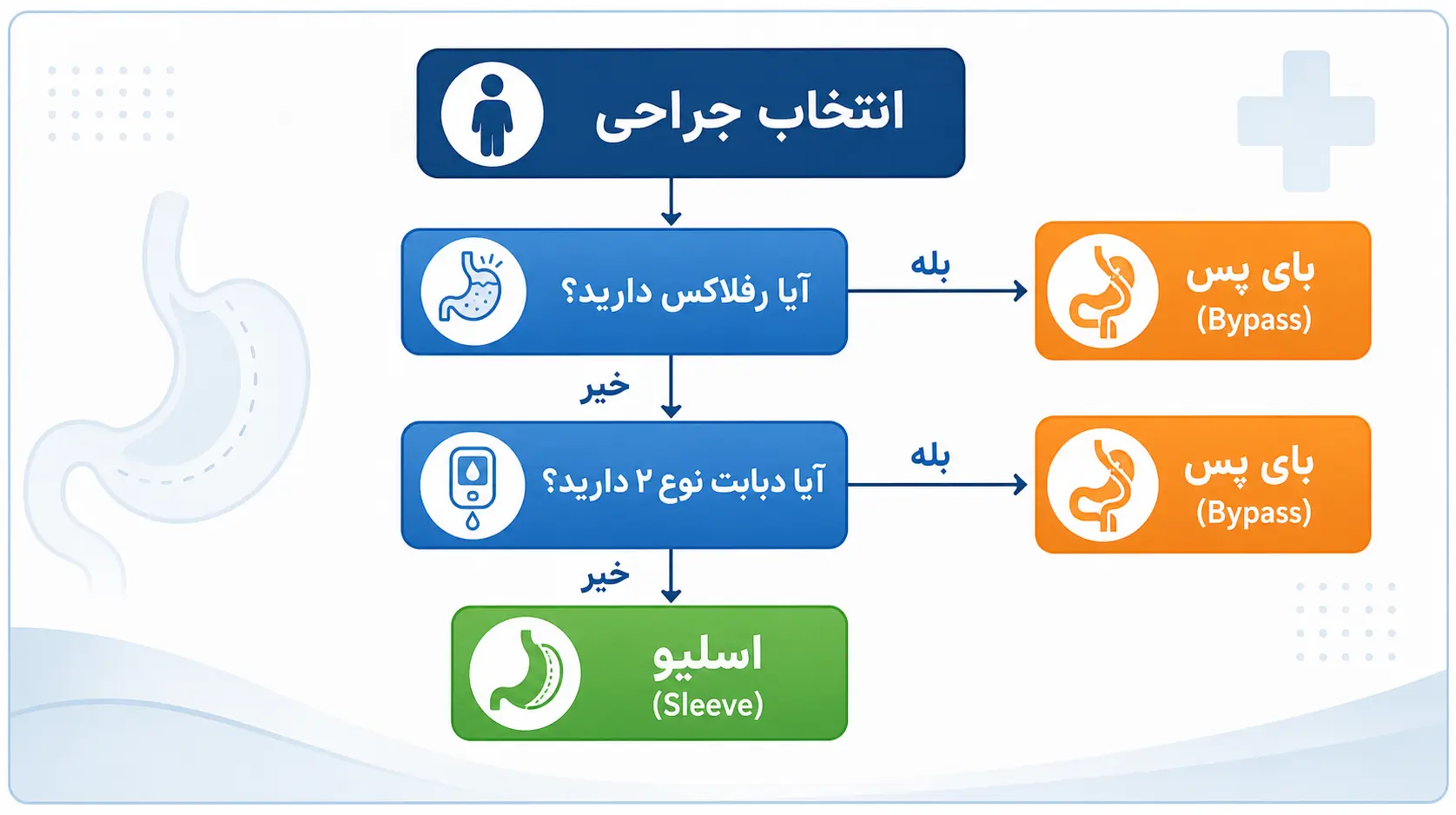 درخت تصمیمگیری برای انتخاب بین اسلیو و بای پس معده بر اساس شرایط بیمار، رفلاکس، دیابت و BMI