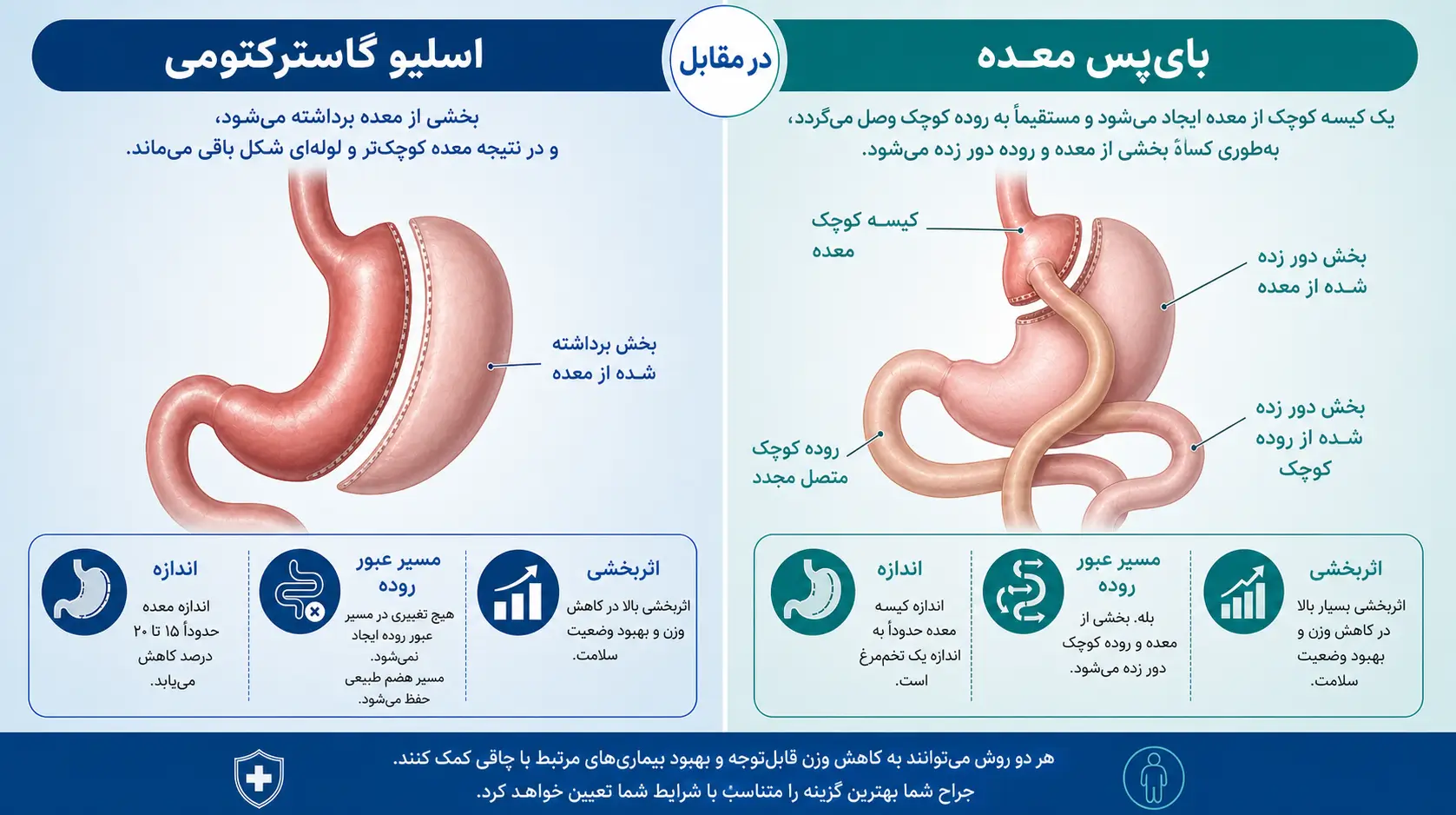 نمودار مقایسه میزان کاهش وزن بعد از اسلیو (۶۵٪) و بای پس (۸۰٪) معده با نمایش تفاوت درصدی و زمان بندی کاهش