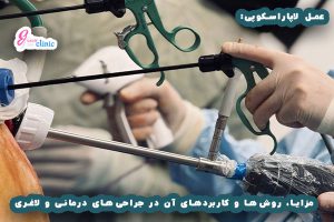 تصویری از جراحی لاپاراسکوپی برای آشنایی با این روش پیشرفته در جراحی‌های داخلی.