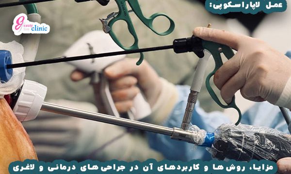 تصویری از جراحی لاپاراسکوپی برای آشنایی با این روش پیشرفته در جراحی‌های داخلی.