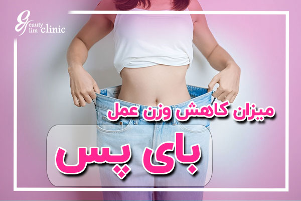 "میزان کاهش وزن پس از عمل بای پس معده به عوامل مختلفی بستگی دارد. در این مقاله، با توضیح مراحل و روند کاهش وزن بعد از بای پس، می‌توانید اطلاعات دقیقی در مورد نتایج معمول و چگونگی حفظ وزن سالم پس از جراحی دریافت کنید." کاهش وزن بعد از جراحی بای‌پس معده چقدر است؟بررسی+توضیح کامل کاهش وزن بعد از جراحی بای‌پس معده چقدر است؟ این مقاله به بررسی میزان کاهش وزن، عوامل تاثیرگذار و راهکارهای رسیدن به بهترین نتیجه بعد از جراحی می‌پردازد.