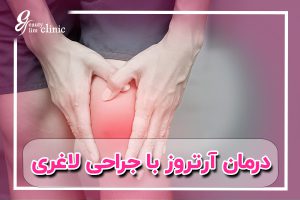 جراحی لاغری می‌تواند به بهبود وضعیت آرتروز و کاهش درد مفاصل کمک کند. در کلینیک اسلیم بیوتی، با جراحی‌های لاغری تخصصی، علاوه بر کاهش وزن، بیماران می‌توانند از مزایای درمان آرتریت بهره‌مند شوند و کیفیت زندگی خود را بهبود بخشند
