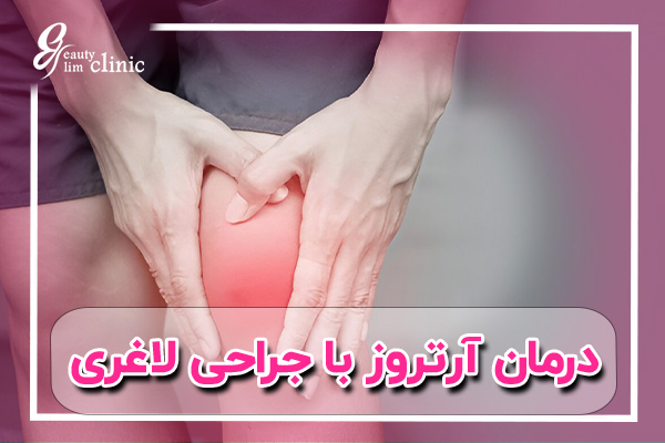 جراحی لاغری می‌تواند به بهبود وضعیت آرتروز و کاهش درد مفاصل کمک کند. در کلینیک اسلیم بیوتی، با جراحی‌های لاغری تخصصی، علاوه بر کاهش وزن، بیماران می‌توانند از مزایای درمان آرتریت بهره‌مند شوند و کیفیت زندگی خود را بهبود بخشند