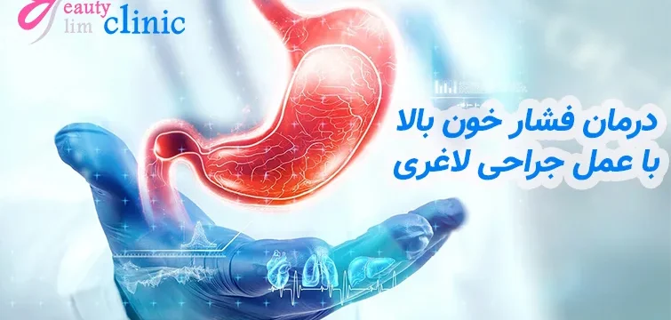 تصویری از جراحی لاغری به عنوان روشی موثر برای کاهش فشار خون بالا و بهبود سلامت بیماران مبتلا به چاقی.