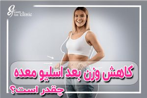 کاهش وزن بعد از عمل اسلیو عمل اسلیو، کاهش وزن، جراحی لاغری، مشاوره لاغری، کلینیک اسلیم بیوتی