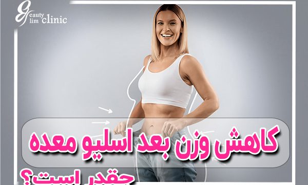 کاهش وزن بعد از عمل اسلیو عمل اسلیو، کاهش وزن، جراحی لاغری، مشاوره لاغری، کلینیک اسلیم بیوتی
