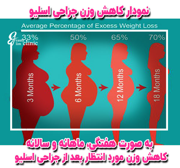 نمودار کاهش وزن جراحی اسلیو را رسم کنید. برای رسم نمودار کاهش وزن بعد از جراحی اسلیو،