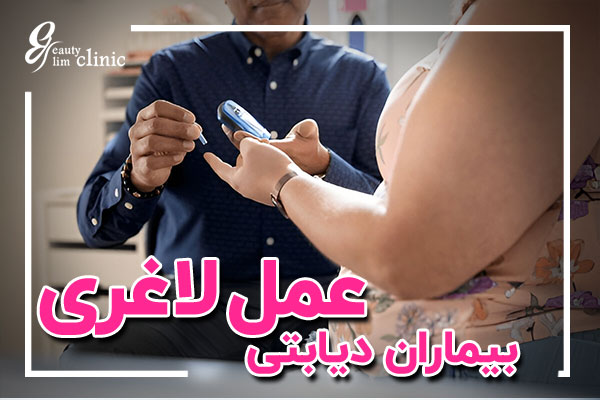 در کلینیک اسلیم بیوتی، جراحی ابدومینوپلاستی برای بیماران دیابتی با دقت و مراقبت‌های ویژه انجام می‌شود. این مقاله به بررسی ایمنی، عوارض و نکات مراقبتی بعد از عمل می‌پردازد و به شما کمک می‌کند تا انتخابی آگاهانه داشته باشید.