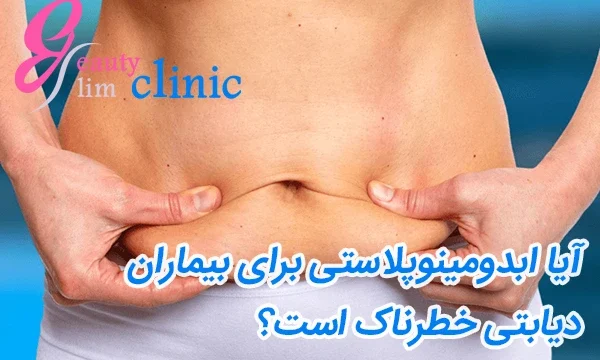 جراحی برای بیماران دیابتی خطر دارد؟+فیلم متخصص جراحی لاغری آیا بیماران دیابتی می‌توانند جراحی ابدومینوپلاستی انجام دهند؟عمل ابدو و بیماران دیابتی مراقبت‌های ویژه. این مقاله به بررسی، عوارض و نکات مراقبتی بعد از عمل تصویری از بیماران دیابتی که تحت جراحی ابدومینوپلاستی قرار گرفته‌اند، نشان‌دهنده فرآیند بهبودی و مراقبت‌های لازم پس از عمل و عوارض جراحی دیابتی