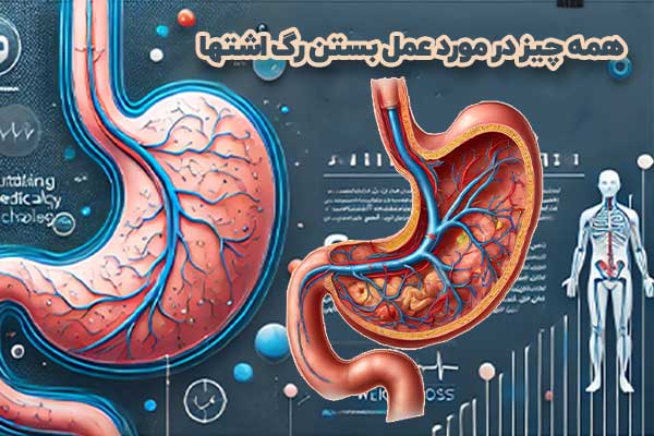 آمبولیزاسیون شریان گاستریک چپ (بستن رگ اشتها) یک روش نوین برای کاهش اشتها و کاهش وزن است که با مسدود کردن شریان گاستریک چپ، ترشح هورمون گرلین را کاهش می‌دهد. در این مقاله، مزایا، معایب و نحوه انجام این تکنیک بررسی می‌شود.