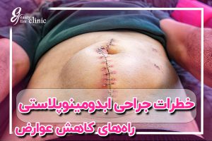 خطر مرگ بر اثر ابدومینوپلاستی: همه چیز درباره جراحی ابدو خطر مرگ بر اثر ابدومینوپلاستی یا تامی تاک، همه چیز درباره خطر مرگ جراحی ابدو، مزایا و مراقبت‌های بعد از عمل را بخوانید. راهی برای داشتن شکمی صاف و جذاب، ابدومینوپلاستی یا تامی تاک، همه چیز درباره جراحی شکم، خطرات، مزایا و مراقبت‌های بعد از عمل را در این مقاله بخوانید.