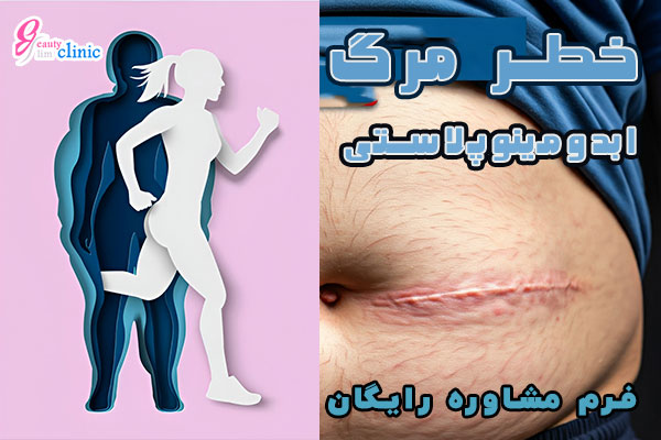 خطر مرگ بر اثر ابدومینوپلاستی: همه چیز درباره جراحی ابدو خطر مرگ بر اثر ابدومینوپلاستی یا تامی تاک، همه چیز درباره خطر مرگ جراحی ابدو، مزایا و مراقبت‌های بعد از عمل را بخوانید. راهی برای داشتن شکمی صاف و جذاب، ابدومینوپلاستی یا تامی تاک، همه چیز درباره جراحی شکم، خطرات، مزایا و مراقبت‌های بعد از عمل را در این مقاله بخوانید.