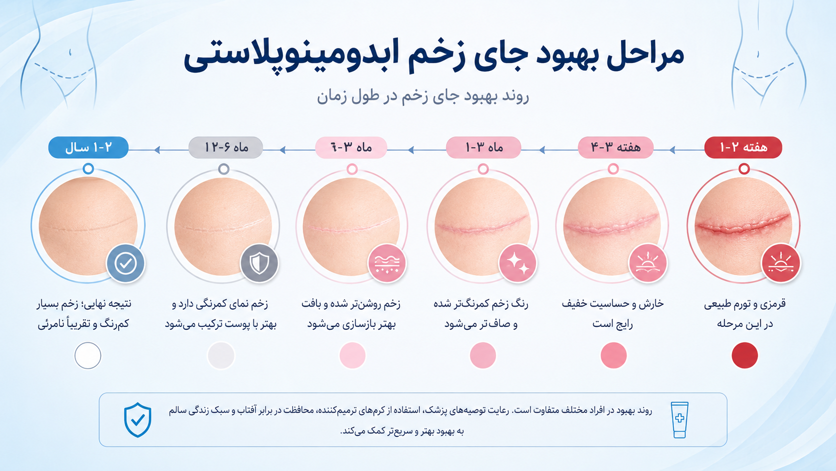 اینفوگرافیک تایملاین ترمیم جای بخیه ابدومینوپلاستی از روز اول تا یک سال