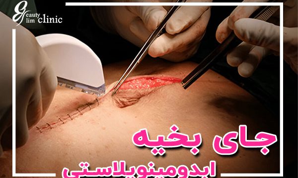 جای بخیه ابدومینوپلاستی؛ نکات طلایی برای بهبود سریع و کاهش اثرات اسکار