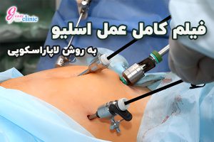تماشای فیلم عمل لاپاراسکوپی اسلیو در کلینیک اسلیم بیوتی فیلم عمل لاپاراسکوپی اسلیو معده در کلینیک اسلیم بیوتی را تماشا کنید. جراحی دقیق و ایمن توسط دکتر سعید سینا و دکتر ماهر کردی، همراه + توضیحات کامل مراحل عمل