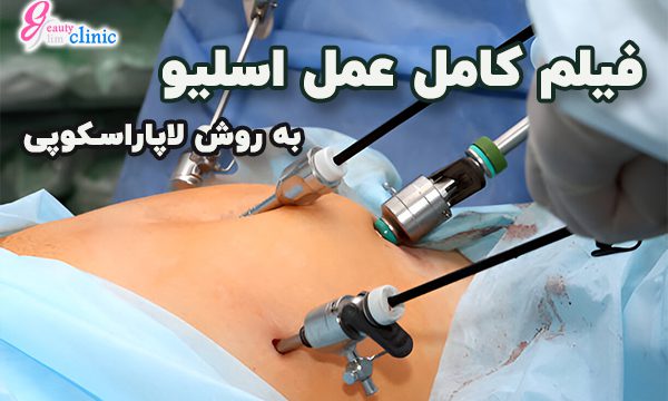 تماشای فیلم عمل لاپاراسکوپی اسلیو در کلینیک اسلیم بیوتی فیلم عمل لاپاراسکوپی اسلیو معده در کلینیک اسلیم بیوتی را تماشا کنید. جراحی دقیق و ایمن توسط دکتر سعید سینا و دکتر ماهر کردی، همراه + توضیحات کامل مراحل عمل