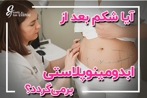 دلایل برگشت شکم بعد از ابدومینوپلاستی
