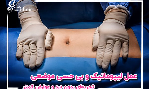 عمل لیپوماتیک بدون بیهوشی با بی حسی موضعی: کاهش چربی بدون درد و سریع‌تر از روش‌های جراحی دیگر. بررسی مزایا و مراقبت‌های بعد از عمل