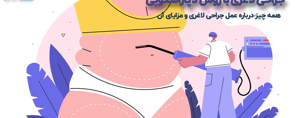 جراحی لاغری با روش لاپاراسکوپی