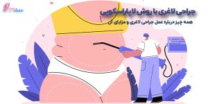 جراحی لاغری با روش لاپاراسکوپی