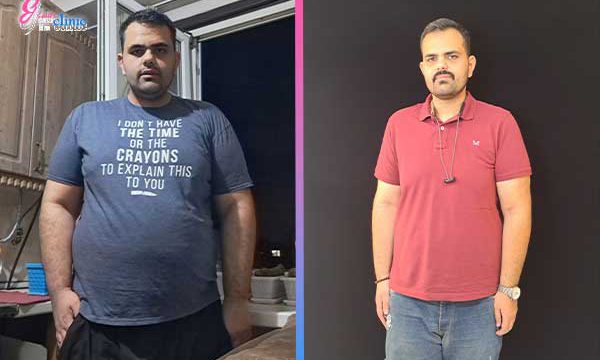 قبل و بعد جراحی بای پس معده مشاهده ویدئوهای تجربیات واقعی و نتایج جراحی لاغری بیماران پس از عمل لاغری در کلینیک اسلیم بیوتی. نتایج شگفت‌انگیز عمل اسلیو معده و بای‌پس معده با مشاوره رایگان