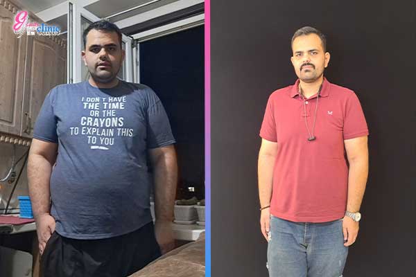 قبل و بعد جراحی بای پس معده