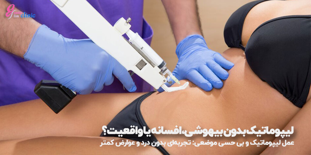 عمل لیپوماتیک بدون بیهوشی با بی حسی موضعی: کاهش چربی بدون درد و سریع‌تر از روش‌های جراحی دیگر. بررسی مزایا و مراقبت‌های بعد از عمل