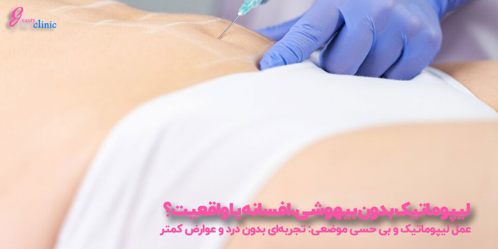 لیپوماتیک بدون بیهوشی - جراحی کم‌تهاجمی برای کاهش چربی شکم