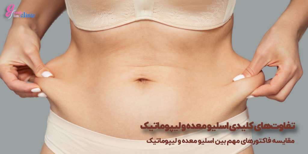 تفاوت‌های بین اسلیو معده و لیپوماتیک
