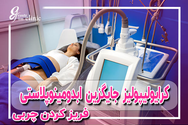 کرایولیپولیز یا کول اسکالپتینگ یک تکنیک فرم دهی بدن است که با انجماد بافت چربی زیر جلدی برای از بین بردن سلول‌های چربی در بدن به کار برده می‌شود.