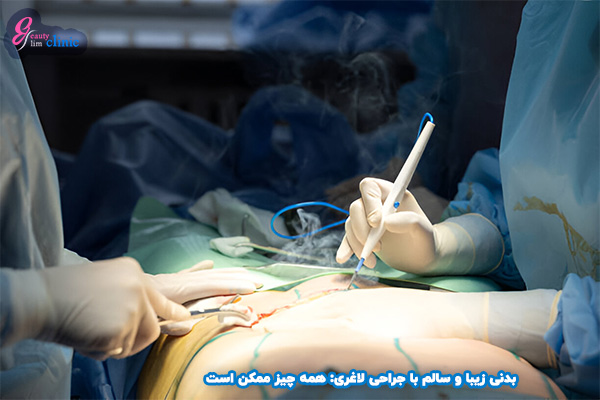 تامی تاک: شکمی صاف و خوش فرم با جراحی