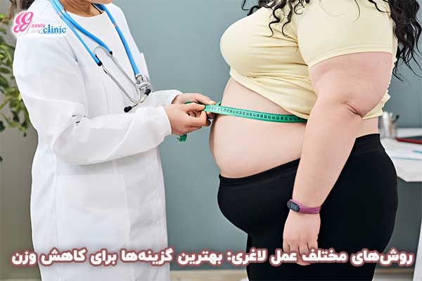 بهترین عمل معده برای لاغری بهترین عمل لاغری: کدام جراحی برای ما بهتر است؟+مقایسه روشها بهترین عمل لاغری در کلینیک اسلیم بیوتی انواع جراحی لاغری شامل بای پس معده، اسلیو معده و بالن معده با روشهای پیشرفته و ایمن، برای مشاوره رایگان نتایج موفق جراحی اسلیو معده در کلینیک اسلیم بیوتی، تغییرات چشمگیر در کاهش وزن مزایا و معایب عمل لاغری: از بای پس معده تا بالن معده،عمل لاغری کدام است؟ اسلیو، بای پس، بالن یا ساسیج؟ 🔥 در کلینیک اسلیم
