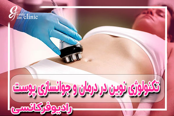 درمان‌های کانتورینگ بدن با فرکانس رادیویی می‌توانند به کاهش چربی و سفت شدن پوست کمک کنند تا شکل و ظاهر بدن فرد بهبود یابد