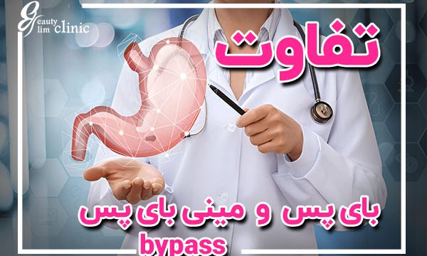 عمل مینی بایپس معده و تفاوت بای پس و مینی بای پس معده: کدام روش برای شما مناسب‌تر است؟