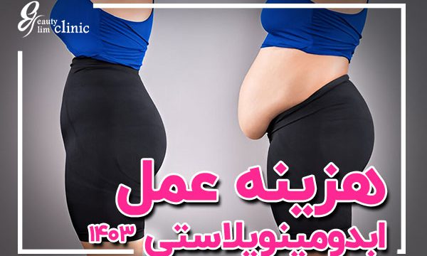 هزینه عمل ابدومینوپلاستی در جراحی ابدومینوپلاستی، عوامل مختلفی مانند حجم چربی، افتادگی پوست و تکنیک‌های جراحی می‌توانند تأثیر زیادی بر هزینه عمل داشته باشند. این مقاله به بررسی عواملی که می‌توانند هزینه جراحی را تحت تأثیر قرار دهند، می‌پردازد