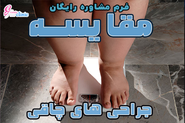 مقایسه روش‌های جراحی چاقی: کدام یک برای شما بهترین است؟ در این مقاله روش‌های جراحی چاقی شامل اسلیو معده و بای پس معده مقایسه می‌شود تا شما بتوانید بهترین روش را برای کاهش وزن انتخاب کنید. مشاوره رایگان