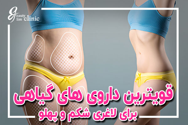 قویترین داروهای گیاهی برای لاغری شکم و پهلو | کاهش چربی با روشهای طبیعی