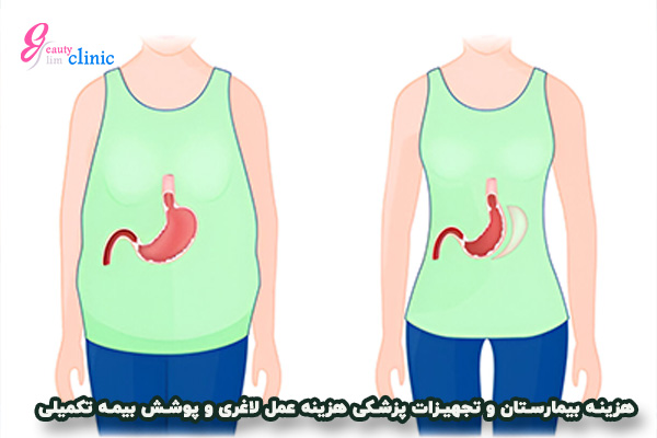 یک راهنمای جامع برای کسانی است که می‌خواهند اطلاعات بیشتری درباره جراحی اسلیو معده و چگونگی بهبودی پس از آن کسب کنند. این فرصت را از دست ندهید و گام‌به‌گام با ما همراه شوید تا بهترین تجربه را از این فرآیند داشته باشید.