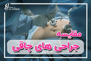 مقایسه روش‌های جراحی چاقی: کدام یک برای شما بهترین است؟