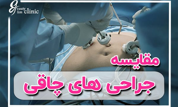 مقایسه روش‌های جراحی چاقی: کدام یک برای شما بهترین است؟