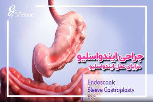 📌عمل ایندواسلیو: جدیدترین روش کاهش حجم معده برای کاهش وزن ✅عمل ایندواسلیو جدیدترین روش کم‌تهاجمی کاهش حجم معده که بدون جراحی سنتی به کاهش وزن کمک می‌کند. روشی ایمن و موثر برای درمان چاقی.مشاوره رایگان کلینیک اسلیم...