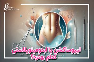 ✨⁩لیپوساکشن(عمل برداشتن چربی شکم) و ابدومینوپلاستی فرق... 🎯مقایسه لیپو (عمل برداشتن چربی شکم) و ابدو چیست؟ راهنمایی کامل برای انتخاب روش مناسب برای جراحی زیبایی شکم، نگرانی‌ها، دوره بهبودی و توصیه‌ برای بهترین تصمیم.