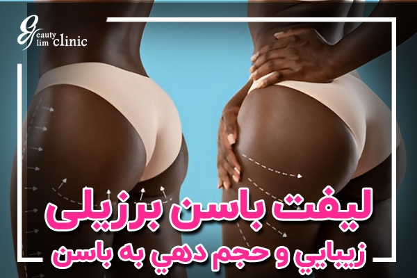تصویری از مقایسه فرم باسن برزیلی با سایر فرمهای باسن، نشاندهنده ظاهر گرد و برجسته باسن برزیلی در کنار فرمهای طبیعی دیگر. این تصویر به بررسی تفاوتهای برجستگی، تناسب و انحنا در باسنهای صاف، مربعی، قلبیشکل، مثلثی و برزیلی میپردازد.