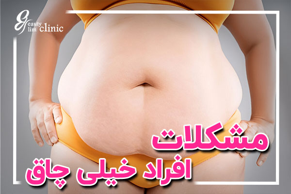 مراحل درمان چاقی مفرط از طریق برنامهریزی صحیح و مشاوره حرفهای