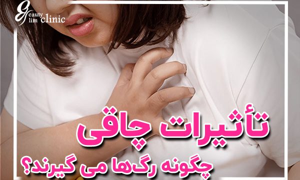 تصویری احساسی از مشکلاتی که افراد دارای اضافه وزن زیاد هنگام تلاش برای کاهش وزن با آن مواجه هستند. تصویر احساسات سرخوردگی، عزم و چالش‌های پیش روی افراد را نشان می‌دهد و به موضوعات سلامت، رژیم غذایی و ورزش پرداخته است.